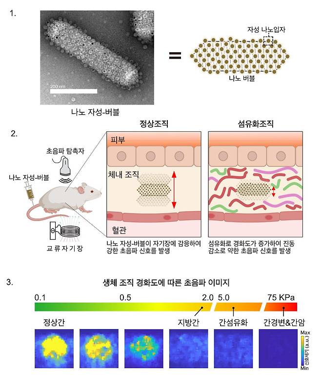 1번은 나노 자성-버블과 자성 나노입자가 결합되어 있는 모습이다. 2번은 나노 자성-버블의 진동정도에 따라 정상조직에서는 강한 초음파 신호를 발생하고, 섬유화 조직에서는 주변이 단단해져 약한 초음파 신호를 발생하는 모습을 보여준다. 3번은 생체조직의 경화도에 따른 나노 자성-버블의 초음파 이미지다./IBS