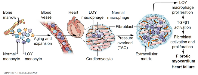 분열이 왕성한 골수의 조혈모세포에서는 Y염색체 소실이 흔해 70세 남성은 백혈구의 40%에 이른다. 혈관을 타고 심장에 자리한 Y염색체 소실 대식세포(LOY macrophage)는 심장수축의 자극(pressure overload)을 받아 증식하며 성자인자(TGF1)를 내보낸다. 사이언스 제공