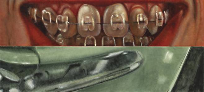 이시 우드 Issy Wood, 봐 엄마, 충치 없어 Look Ma, no cavities, 2023, Oil on velvet, 120×265×6cm. 사진 제공: 일민미술관, (C) Issy Wood, 2023; courtesy the Artist; Carlos/Ishikawa, London; and Michael Werner Gallery, New York. Photographer: Damian Griffiths