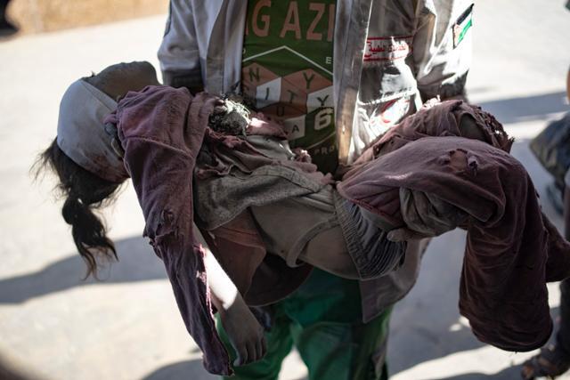6일 이스라엘의 가자지구 폭격에 다친 한 팔레스타인 소녀가 칸유니스의 병원으로 이송되고 있다. 가자지구=AP 뉴시스