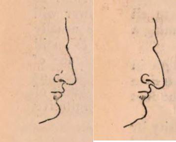 빅토리아 시대의 관상학에 따른 '로마인 코(좌)'와 '유대인 코(우)' .(1852) Notes on Noses, George Jabet