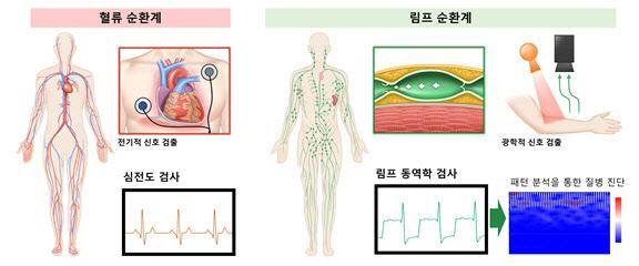 심전도 검사와 림프 동역학 검사 비교