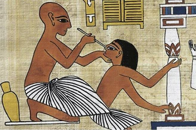 고대 이집트 파피루스의 치료술 관련 한 장면. /에버스 파피루스
