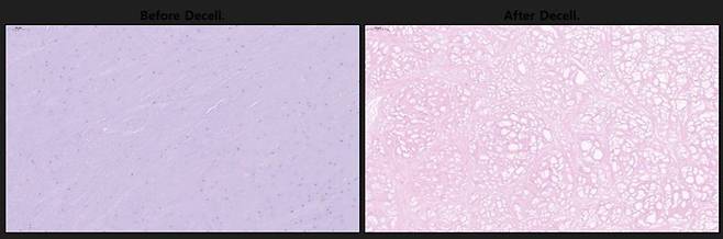 엠젠솔루션 탈세포화 전후 모습. 사진=엠젠솔루션