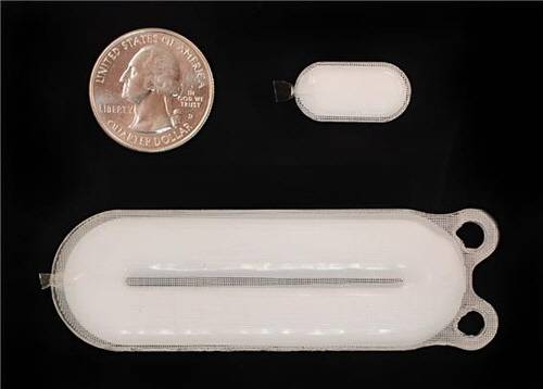 인슐린 베타세포를 생산하는 '임플란트' 모습
연합뉴스 제공