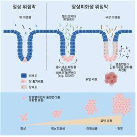 장상피화생 위암 진행 관여하는 유전자 변이 규명/ 서울대병원 제공