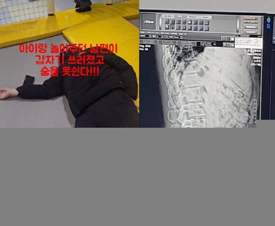 가수 노유민이 기절한 모습(왼)과 엑스레이 사진./사진=노유민 인스타그램 캡처