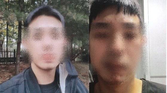 지난해 10월 15일 10대 2명으로부터 무차별 폭행을 당한 A씨(34) 얼굴. 사진 왼쪽은 사건 전 모습이고 오른쪽은 신경 손상과 턱 관절 골절 등으로 얼굴이 틀어진 모습. 사진 A씨 측 변호인