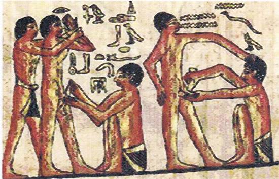 고대 이집트 수도였던 사카라 왕족 무덤에 남아 있는 할례의 이미지.