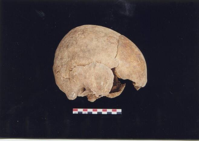2000년 발굴된 승갑의 머리뼈. 오른쪽 아래가 눈두덩. 청계 인류진화연구소 제공
