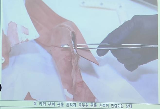 흉기로 관통된 이재명 대표 와이셔츠 옷깃 [부산경찰청 제공. 재판매 및 DB 금지]