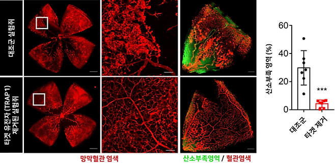 트랩원 유전자 제거 시 망막병증 개선 효과 검증 연구그림.