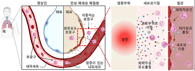 정상인-만성 폐쇄성 폐질환 환자의 호중구 혈관내피세포외 이동. 한국화학연구원