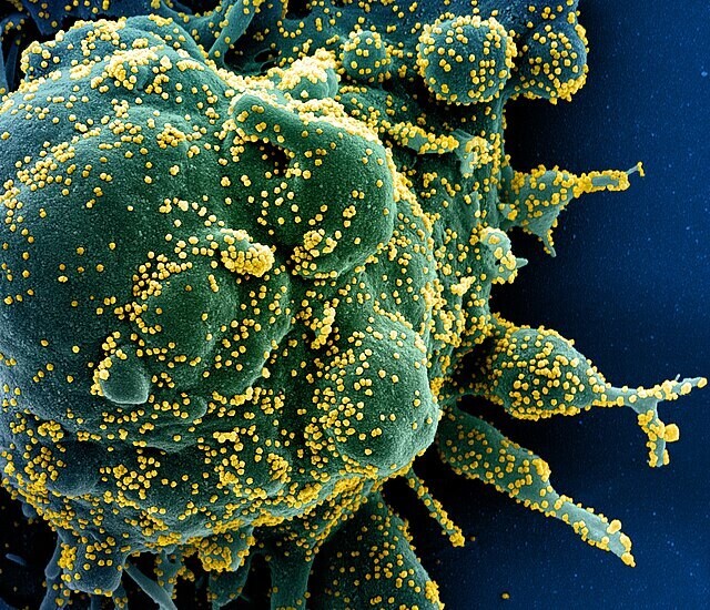 코로나19 바이러스(노란색)에 감염된 세포. 바이러스의 목적은 우리를 괴롭히는 것이 아니라 복제를 통한 자기 유전자 보존이다. 위키미디어 코먼스