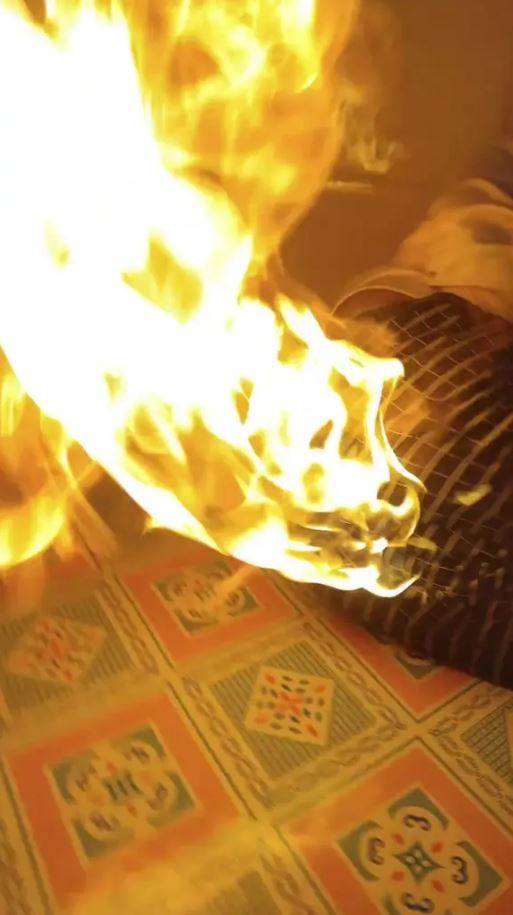 중국에서 사는 빈 타우지는 방귀를 뀌면서 친구와 장난을 치다가 엉덩이에 불이 붙었다./사진=뉴욕 포스트