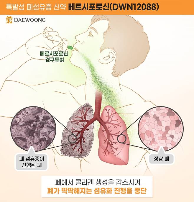 베르시포로신(DWN12088) 작용 기전