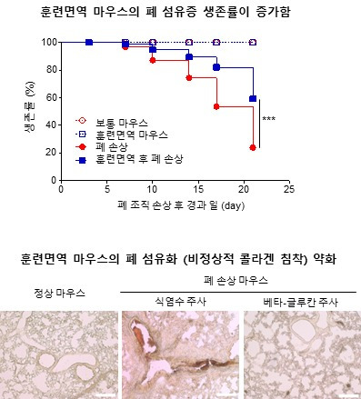 베타-글루칸으로 유도한 훈련면역이 마우스의 폐섬유증을 완화한다는 자료.(울산의대 제공)/뉴스1