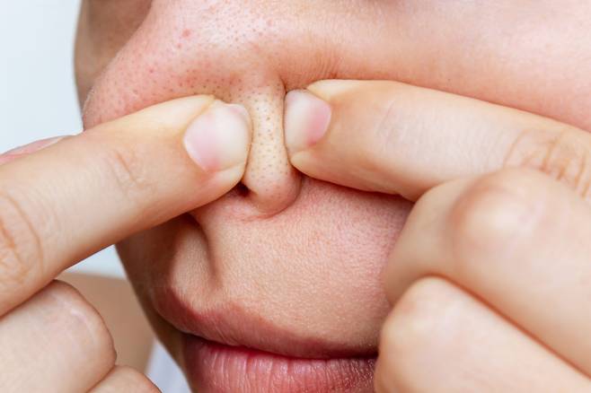 코 주위 기름이 지는 이유? 비타민 B2나 아연이 부족해서 일 수 있다. 페타 치즈, 아몬드, 고등어, 아스파라거스가 좋다. [사진=게티이미지뱅크]