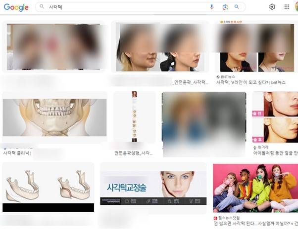 '사각 턱'을 검색하면 각진 부위가 두드러지게 나온 측면 사진이 상대적으로 많이 보입니다. [사진=구글 검색 화면 캡처]