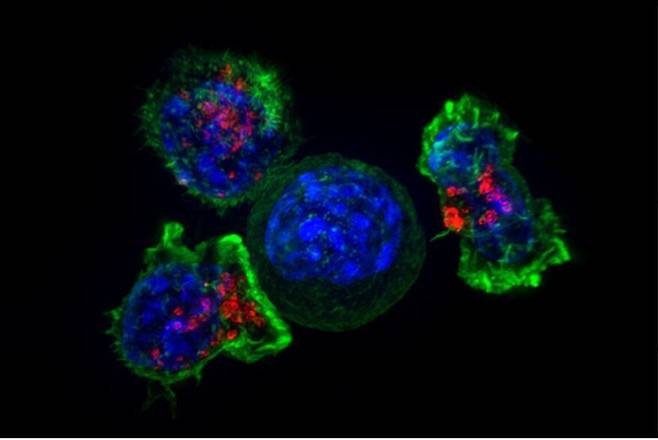 암세포(파란색, 가운데)를 둘러싸고 있는 킬러 T 세포(녹색 및 빨간색). 위키미디어 코먼스