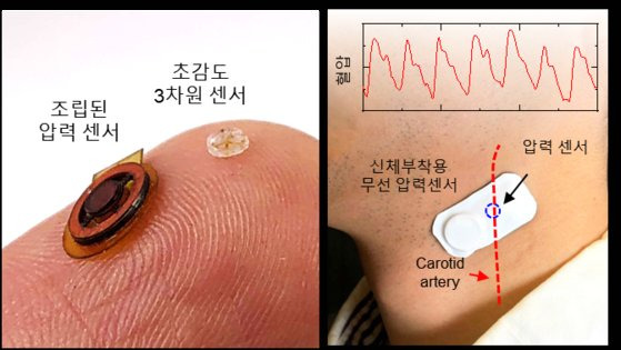 온도 및 외부 자극에 독립적으로 작동하는 초감도 피부 부착형 센서