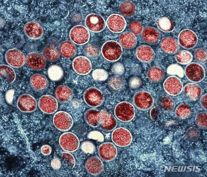 [AP/뉴시스] 미국 국립알레르기감염병연구소(NIAID)가 제공한 이미지로, 투과전자현미경으로 감염된 세포(파란색) 내 원숭이두창 입자(빨간색)가 보이고 있다. 2022.07.31.