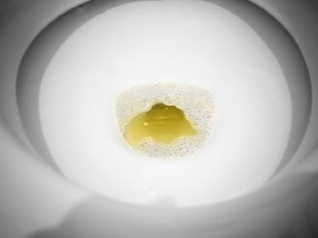 거품이 많은 소변을 본다면 신장 기능이 저하돼 단백질이 과도하게 소변으로 배출되는 ‘단백뇨’일 수 있다./사진=게티이미지뱅크