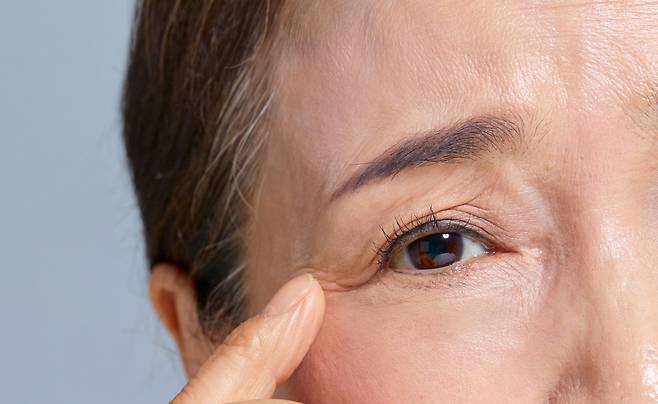 나이 들면서 눈가 지방이 빠지거나 피부가 늘어져 반복적으로 접히면 그 자리에 쌍꺼풀이 생길 수 있다./사진=게티이미지뱅크