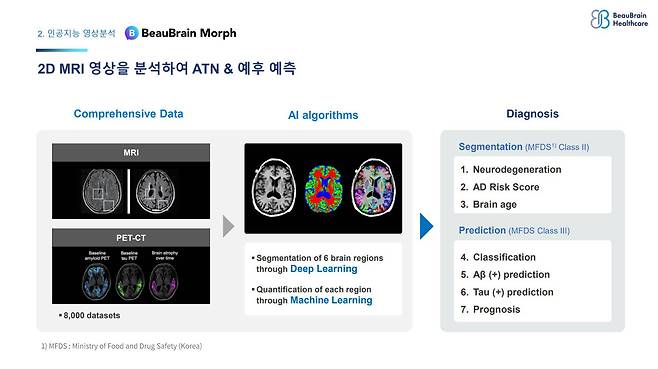 인지기능 검사를 디지털화하고 인공지능으로 2D MRI 영상을 분석, 진단 속도와 정확도를 높였다. / 출처=뷰브레인헬스케어