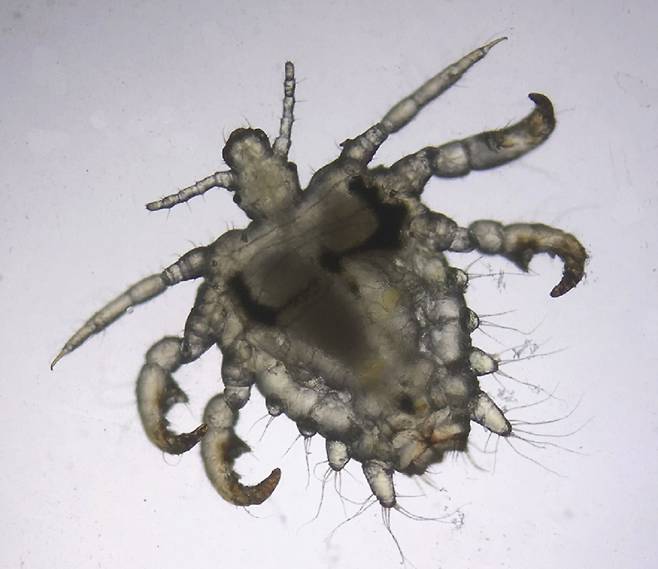 사면발이는 성관계 등에 의해 생식기 근처 체모에 감염될 수 있으며, 주로 가려움증을 유발한다. 사면발이는 게 모양이며, 평균 몸길이는 1.5~2mm다. 일반인의 눈에는 큰 비듬 조각처럼 보이기도 한다. 사진은 사면발이를 현미경으로 확대한 모습./사진=Dermoscopy of pediculosis pubis