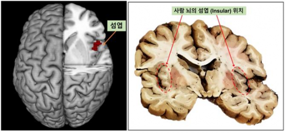 ③ - 가상환경(VE)의 불이 난 상황에서 위험에 처한 사람을 구하고자 이타적인 결심을 한 피험자들의 경우에 대뇌의 앞쪽 가장자리인 전전두엽에 존재하는 섬엽(Insular Cortex) 부분에서 뇌활성 신호가 크게 증가돼 발견됨(왼쪽). 실제 사람 뇌를 관상면(Coronal Plane)으로 자르고 관찰한 섬엽의 위치. 출처: Patil et al., 2018 Neuropsychologia 116:34-43·KIST 뇌과학연구소 제공