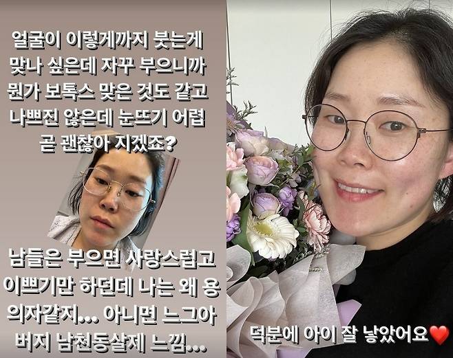 박슬기 소셜미디어