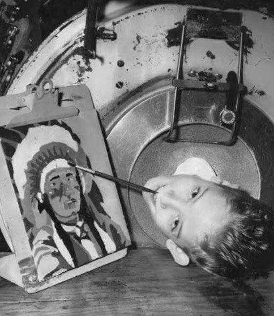 어린 시절 알렉산더가 철제 폐 속에서 입에 붓을 물고 그림을 그리고 있다. 사진 달라스 모닝 뉴스