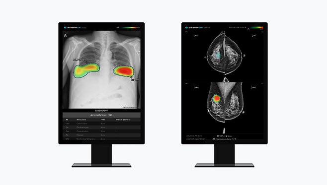 루닛 흉부 엑스레이 AI 영상분석 솔루션 ‘루닛 인사이트 CXR’(왼쪽) 및 유방촬영술 AI 영상분석 솔루션 ‘루닛 인사이트 MMG’ <루닛>
