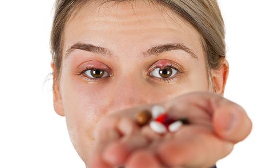 다래끼는 눈꺼풀의 분비샘에 생긴 염증이다ㅣ출처: 게티이미지뱅크