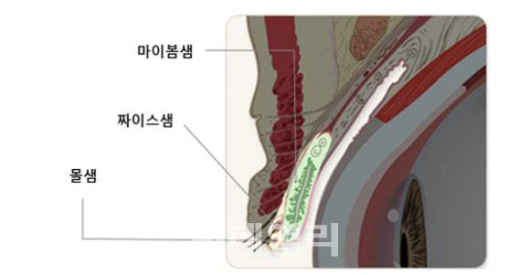 눈물샘의 구성 (자료=국가건강정보포털)