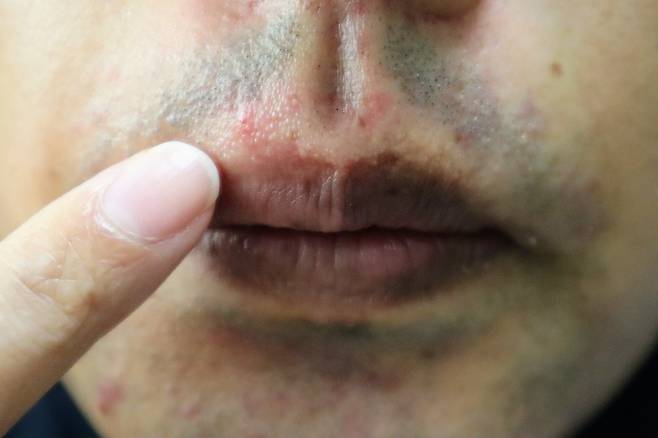 면도 독을 예방하려면, 면도 전 피부를 깨끗이 씻어 피부에 붙어있던 균들을 제거하는 게 좋다./사진=게티이미지뱅크