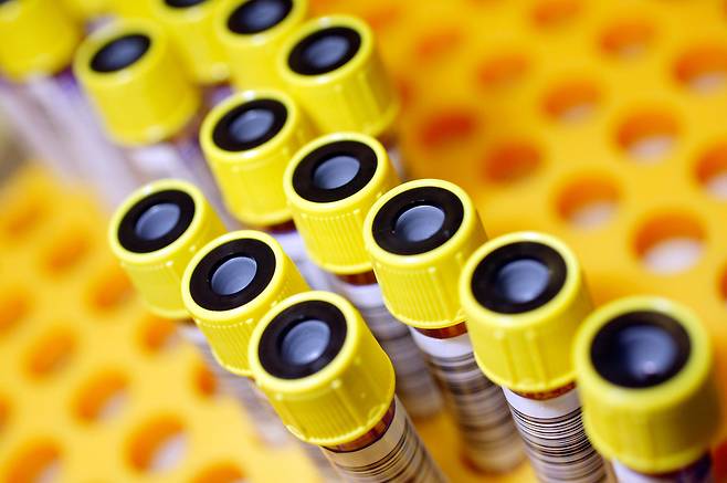 알츠하이머병이 골수 이식을 통해 전염될 수 있다는 연구 결과가 나왔다./사진=클립아트코리아