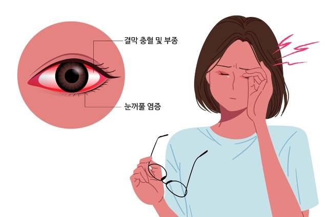 결막염의 증상. 게티이미지뱅크