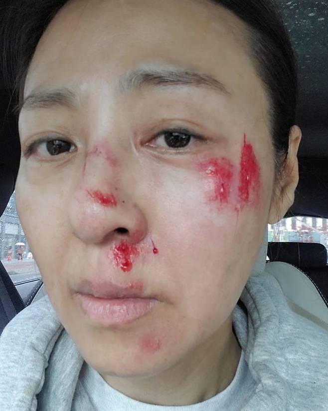 사진=전혜진 SNS