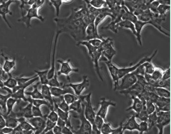 AI 생성 유전자 편집기 '오픈크리스퍼-1'으로 편집된 인간 세폼 [미 프로플루언트 홈페이지 캡처. 재판매 및 DB 금지]