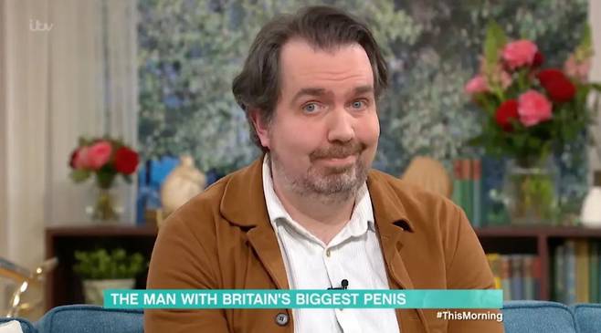 음경이 너무 커 생활이 불편한 경우 음경 축소술을 진행할 수 있다./사진=영국 방송 This Morning 캡처
