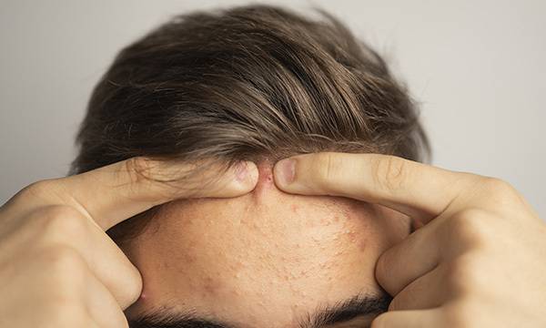 기사의 이해를 돕기 위한 자료 사진. 게티이미지 제공