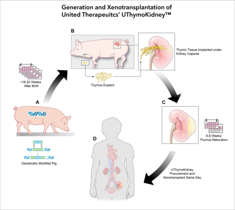 유전자 조작 돼지의 신장을 사람에게 이식하는 일련의 과정을 나타난 그림. 사진=비지니스 와이어/유나이티드 테라퓨틱스 코포레이션