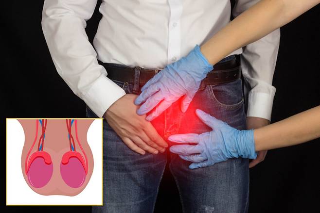 남성 건강을 이야기 할 때 빼놓을 수 없는 고환. 정자를 생산하며 테스토스테론을 관장한다. [사진=게티이미지뱅크]