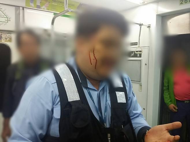 2019년 한 시민에게 폭행을 당해 피흘리는 보안관의 모습. /사진=본인제공