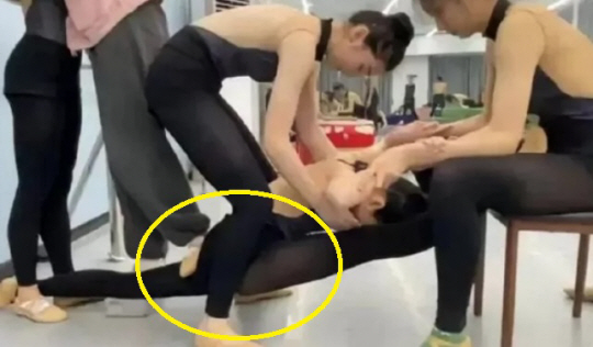 중국 유명 무용 학원에서 한 여학생이 ‘다리 찢기’를 하던 중 다리가 부러지는 사고가 발생했다. 웨이보 캡처