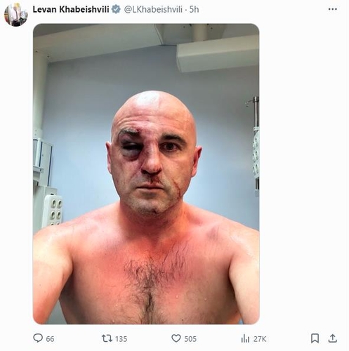 조지아 의회 야당 대표가 시위 중 부상 당했다며 올린 사진 [조지아 '국가운동연합' 대표 레반 하베이슈빌리 X 캡처. 재판매 및 DB 금지]