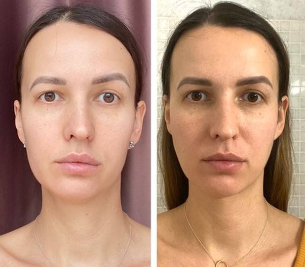 조명의 차이로 비대칭이 개선된 듯한 느낌을 주는 광고 사진