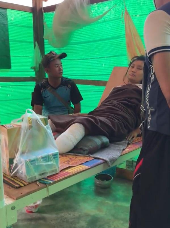 지뢰에 다리를 잃은 미얀마 소녀 마야예 마르가 지난달 12일 미얀마와 태국 국경 지대에 마련된 임시 병원에서 난민 지원단체 관계자 등과 대화하고 있다. KTJ서포팅그룹 제공